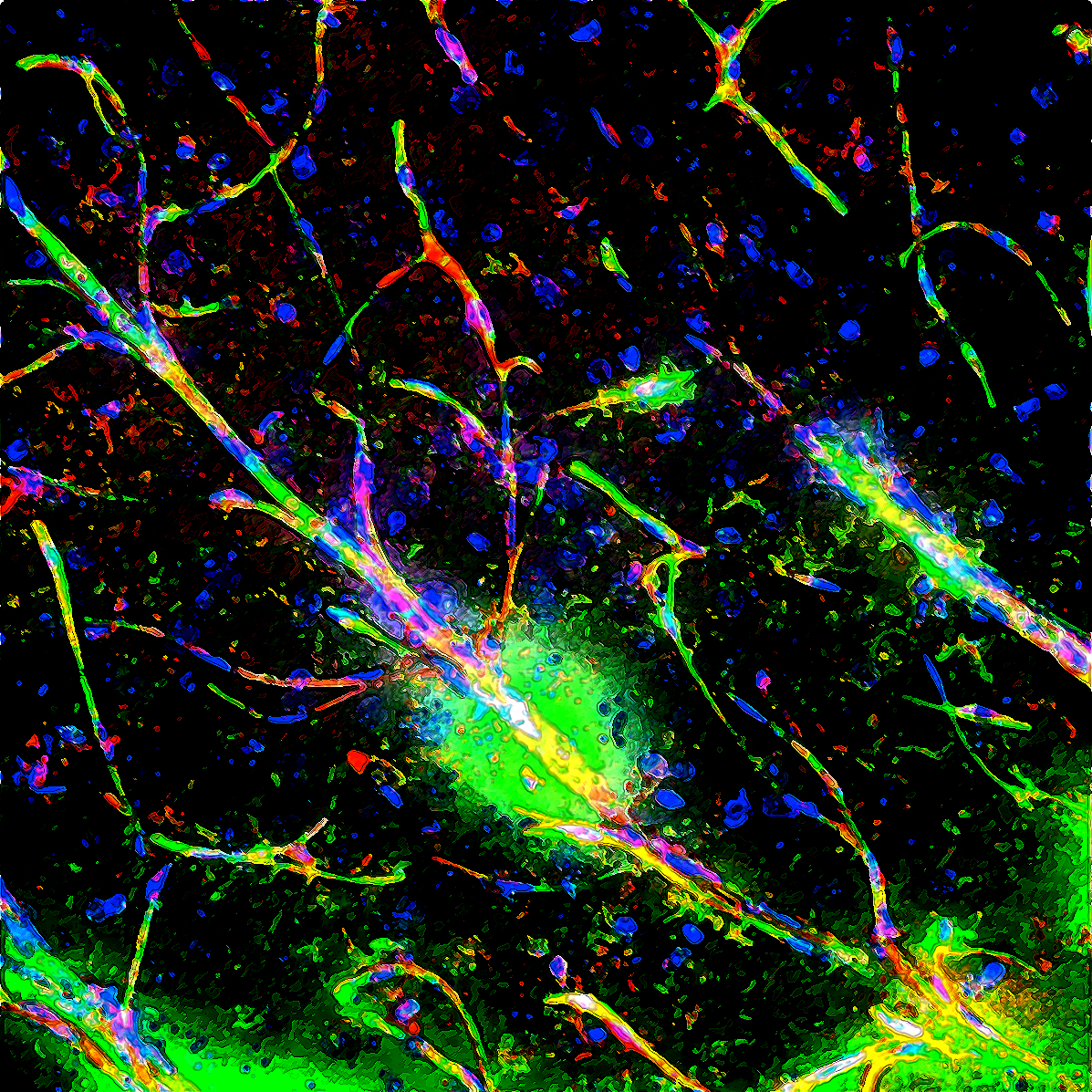 The immune link between a leaky blood-brain barrier and schizophrenia