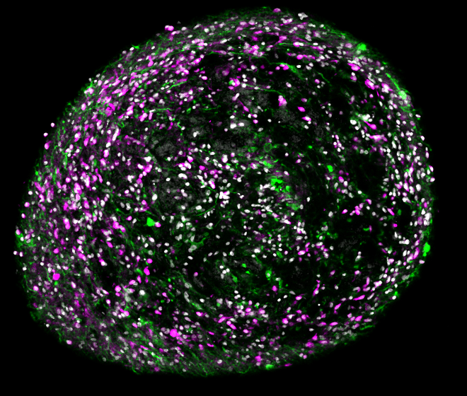 Arcuate organoids to study development and disease of the hypothalamus