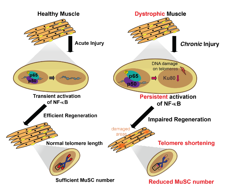 Pathway behind muscle breakdowns in Duchenne muscular dystrophy discovered