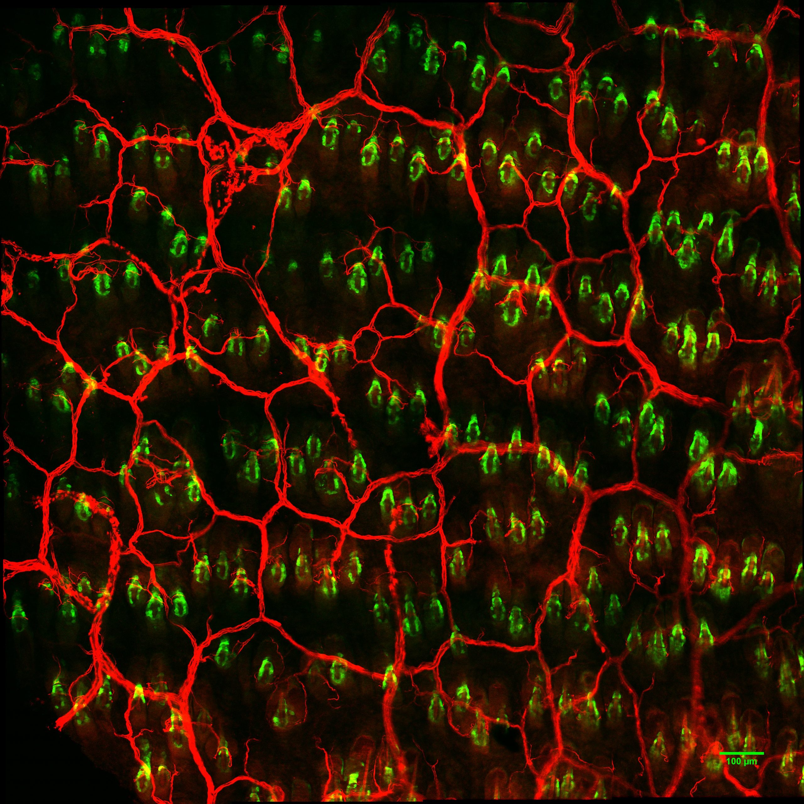 Distinct first responder cells lead the skin’s wound healing response