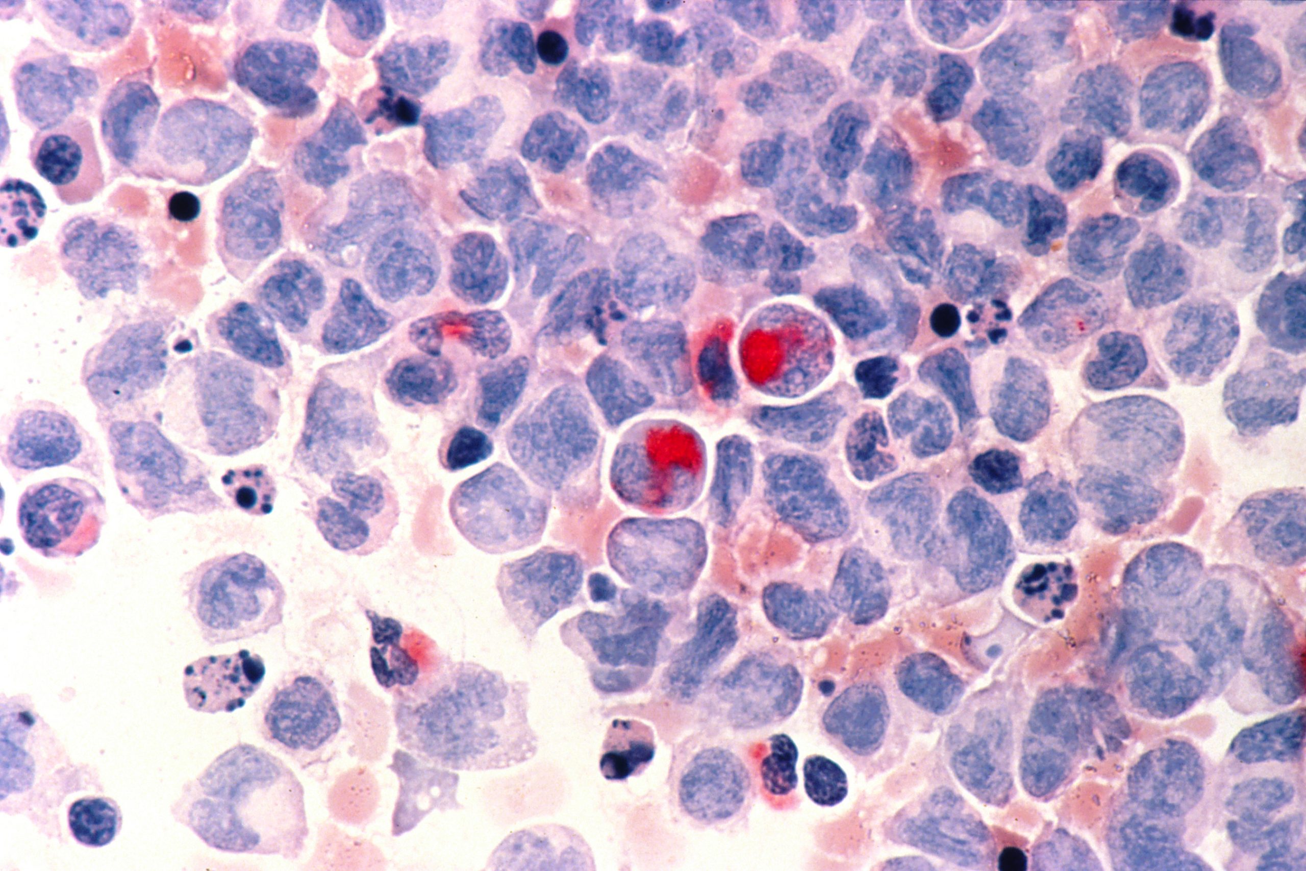 Changing the identity of cancer cells to eliminate them