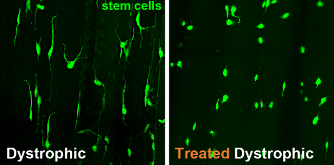 Piezo1 Possible Key to Supporting Muscle Regeneration in Duchenne Muscular Dystrophy