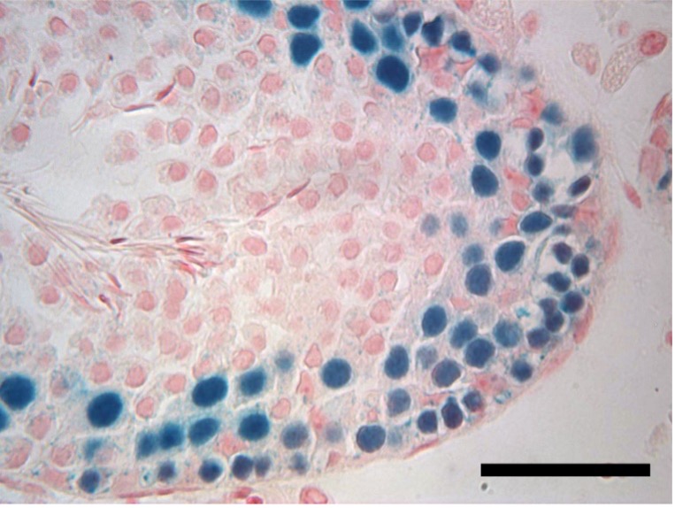 Frozen testicular tissue still viable after 20 years