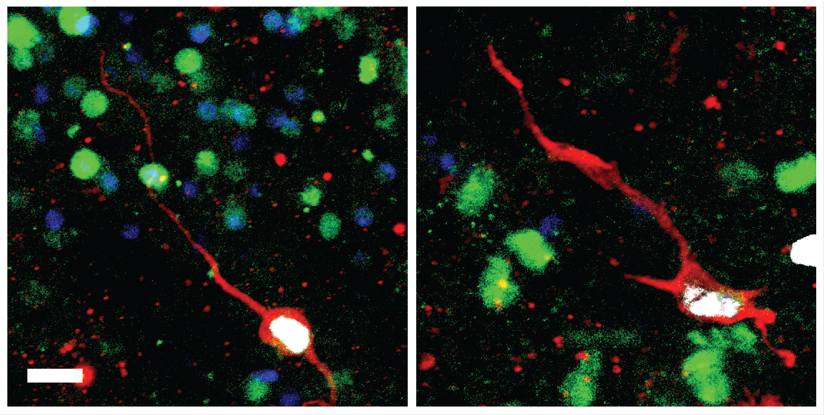 Discovery of Molecular Signatures of Immature Neurons in The Human Brain Throughout Life Provide New Insights into Brain Plasticity and Other Functions