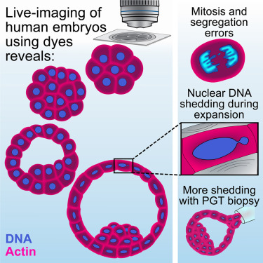 Human embryo live imaging reveals nuclear DNA shedding during blastocyst expansion and biopsy