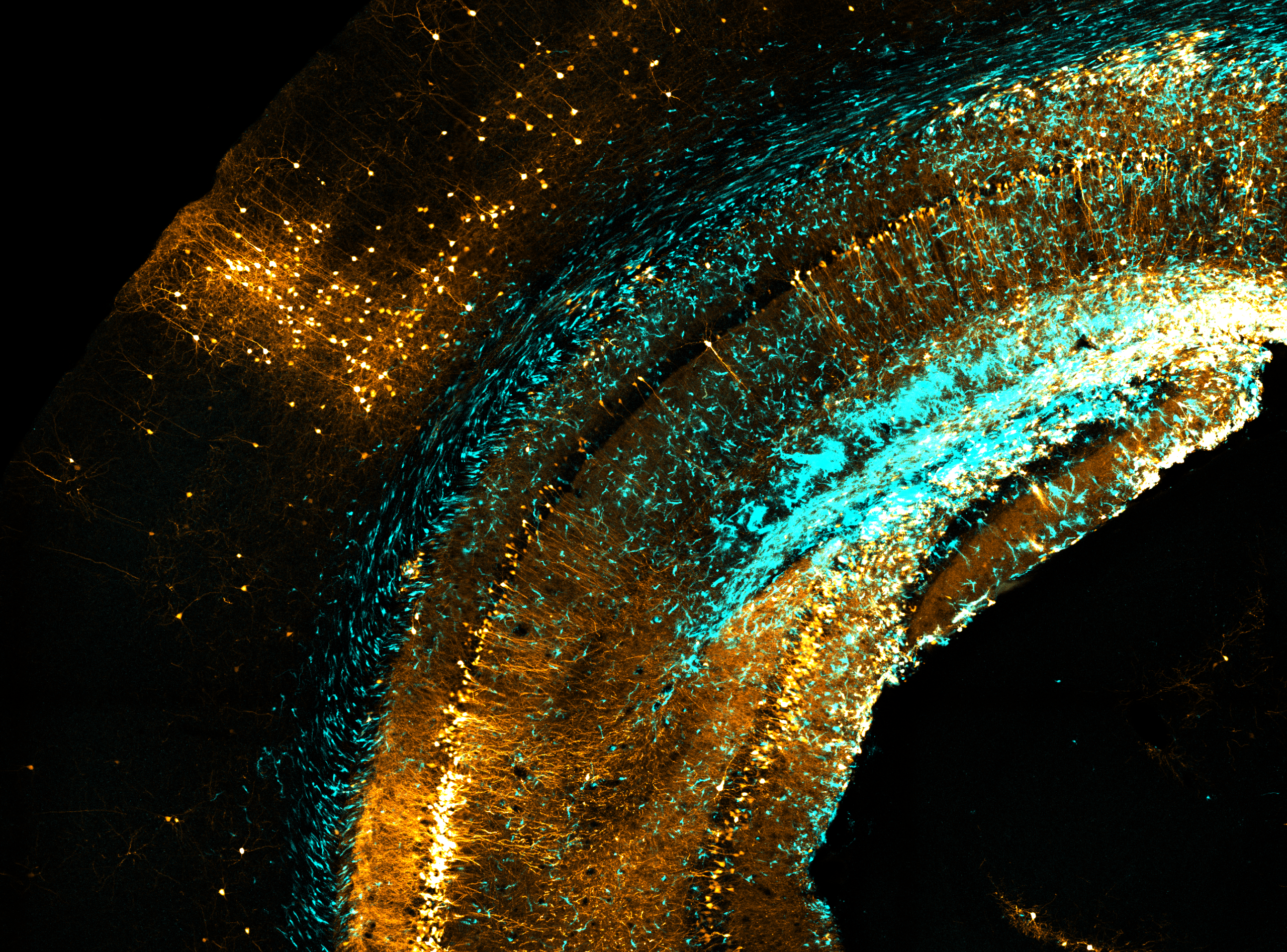 IRM Faculty publish Nature paper on the connectome of glioblastoma cells