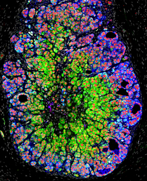 Modeling human prenatal adrenocortical functional zonation dynamics from pluripotent stem cells