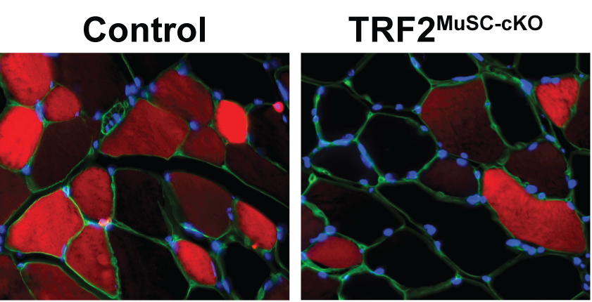 TRF2 couples muscle stem cell identity to regenerative repair