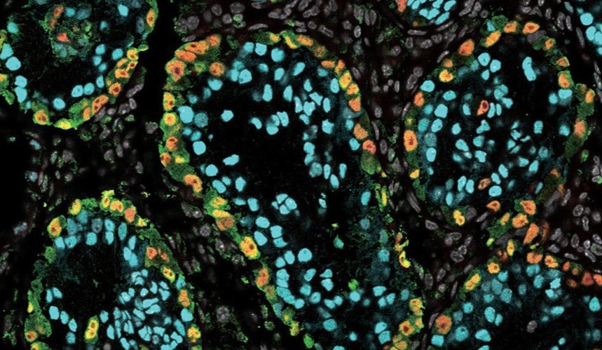 Generation of spermatogonia from human and non-human primate pluripotent stem cells